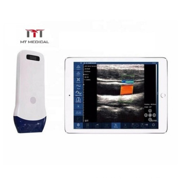 Newest Mini Color Doppler Handheld Pocket Wireless Ultrasound Machine Linear Probe